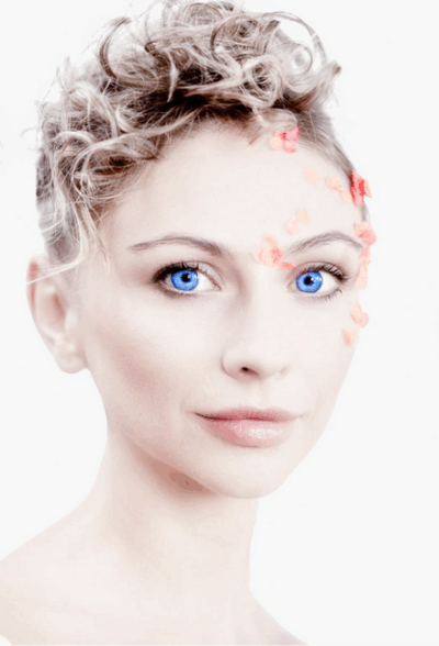 Dr. Alfons Wolf - Blue Eyes - Annahme