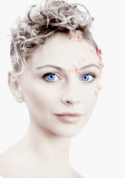 Dr. Alfons Wolf - Blue Eyes - Annahme